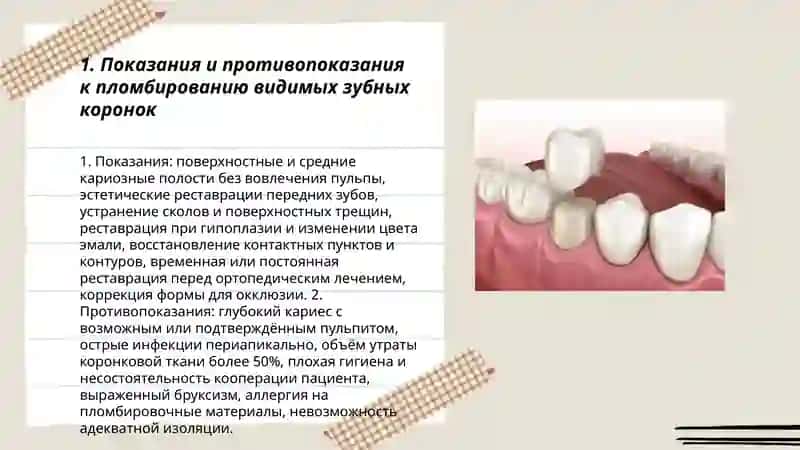 Пломбирование зубов. Видных зубнох коронок 3