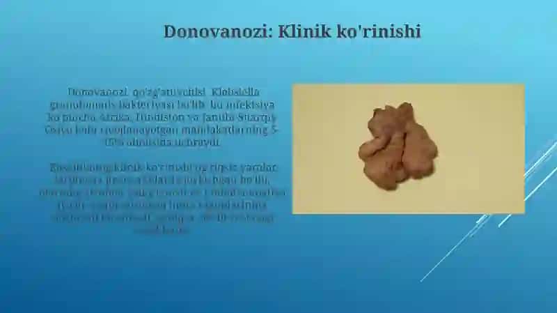 Venerik limfogranulema 3