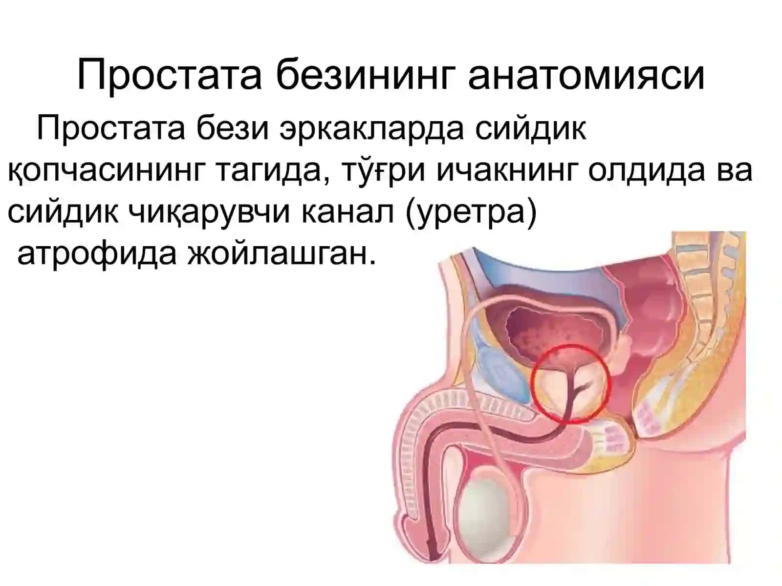 Простата бези хавфсиз гиперплазияси 3