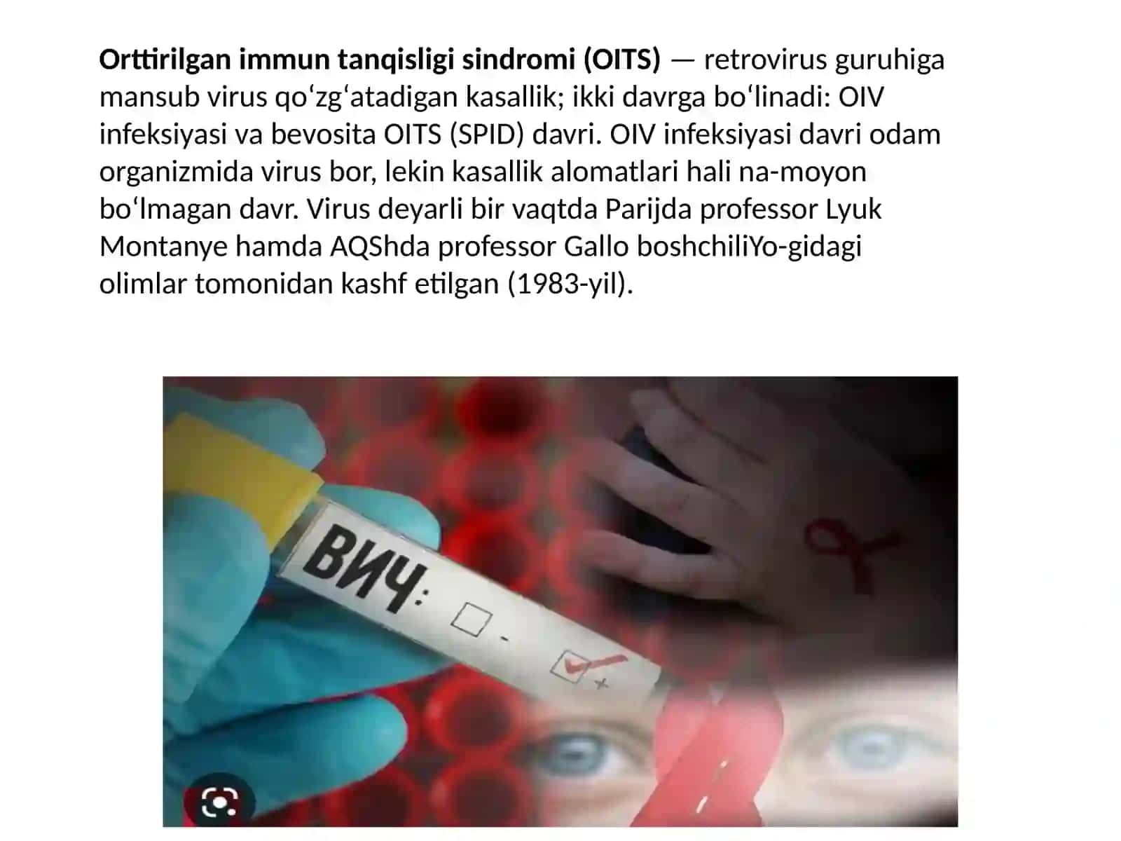 Spidvavichprofilaktikasi 3