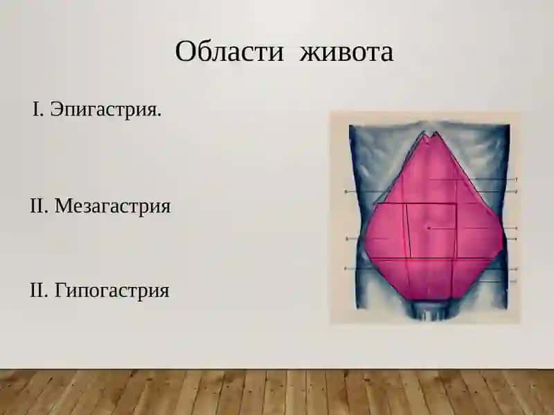 Острый живот 3