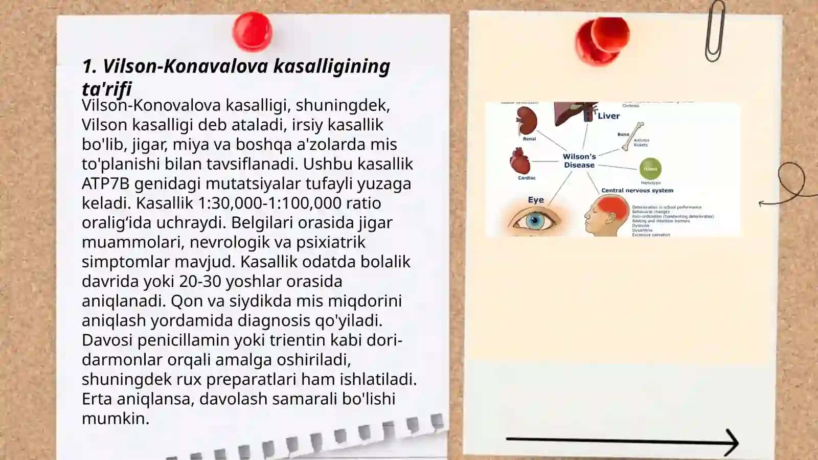 Vilson -Konavalova kasalligi 3