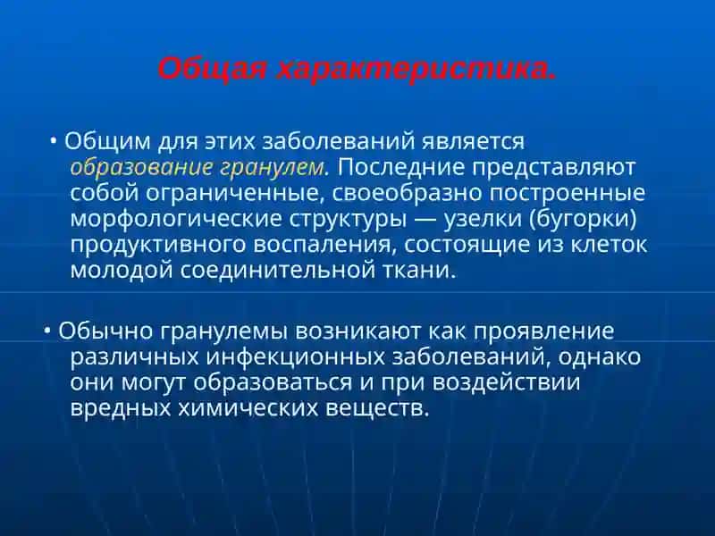 Вегенергрануломатозида ЛОР азоляризарланиши ЛОРа’золариспецификкасалликлари 3