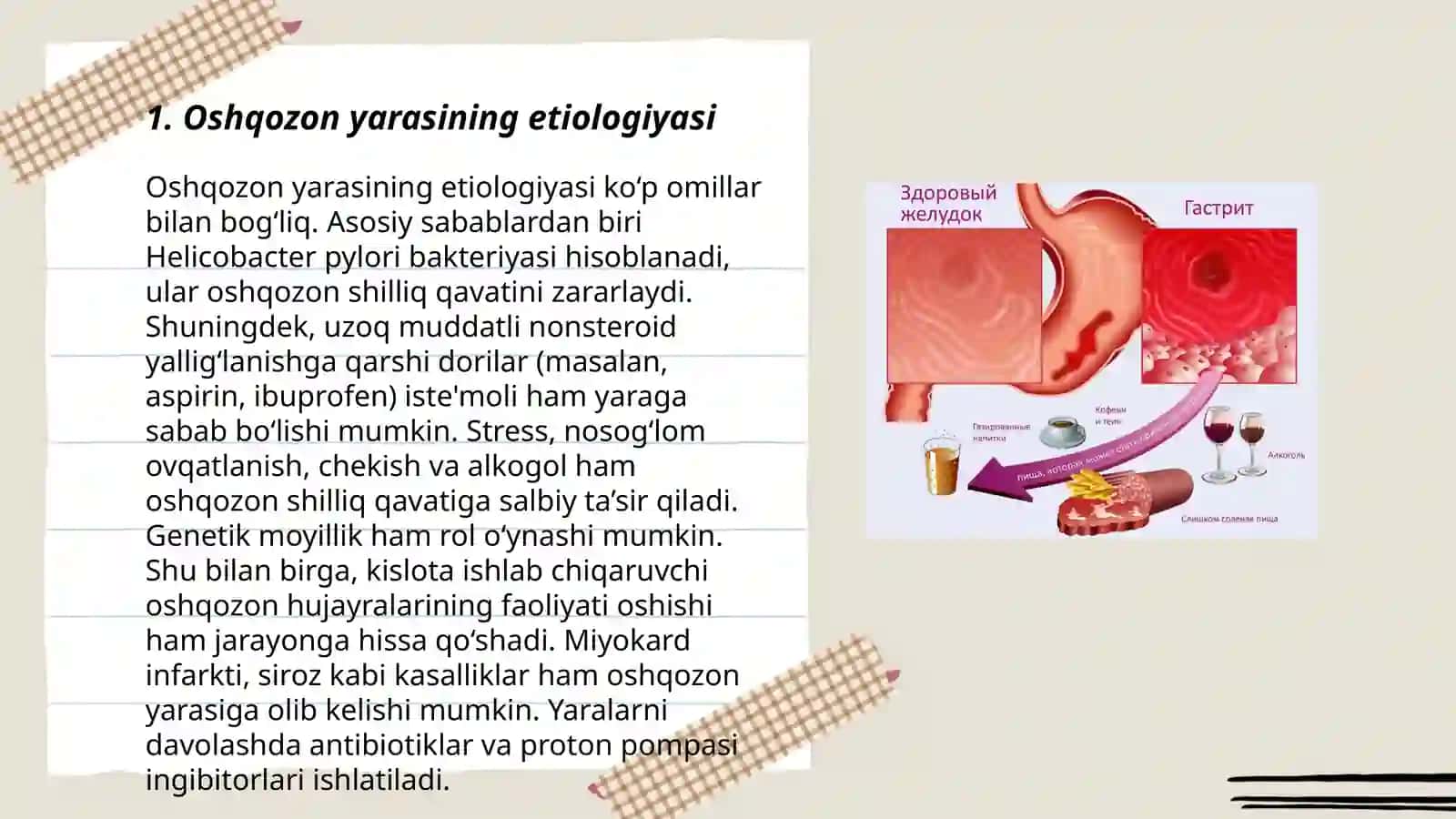 Oshqozon yarasi kasalligi:etiologiyasi va patogenezidagi zamonaviy aspektlar 3
