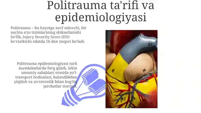 Politrauma ta'rifi va epidemiologiyasi 3
