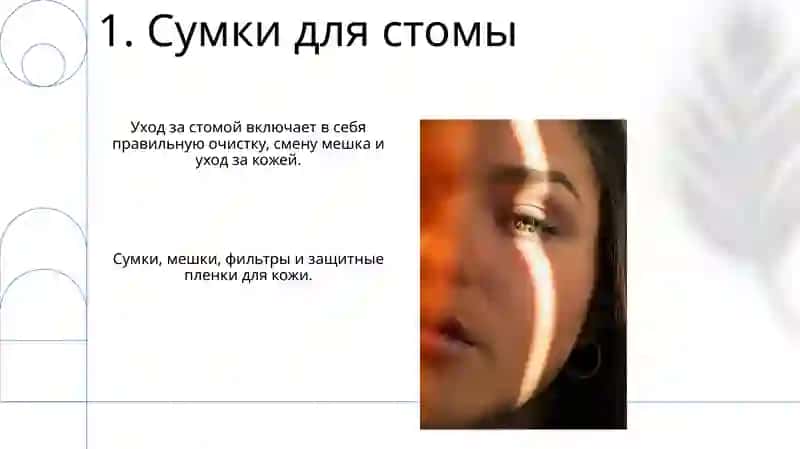 Уход за стомой (стоматология) 3