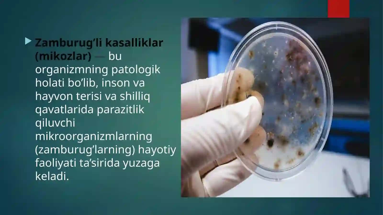 Zamburug’lik assaliklarning qo’zg’atuvchilari, Patogenezi, labaratoriya tashxisi 3