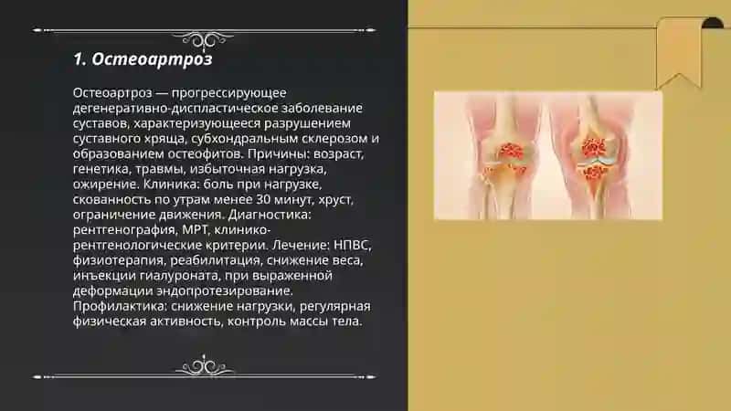 Остеоартроз 3