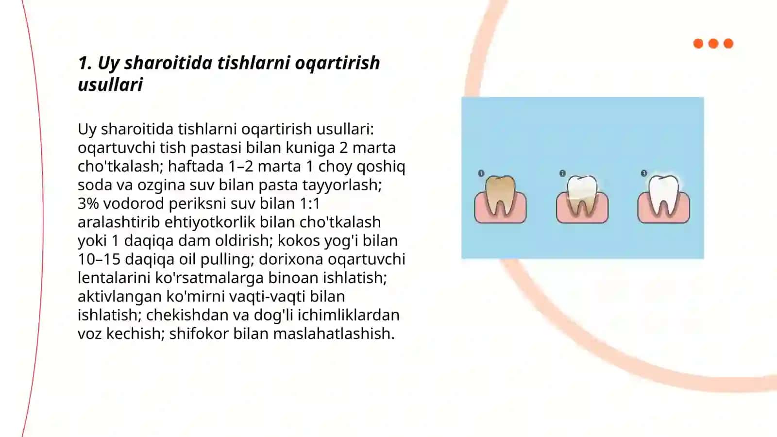 Tishlarni oqartirish uslubi 3