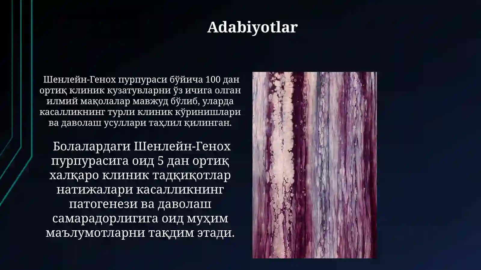 Шенлейн-Генох пурпураси 3