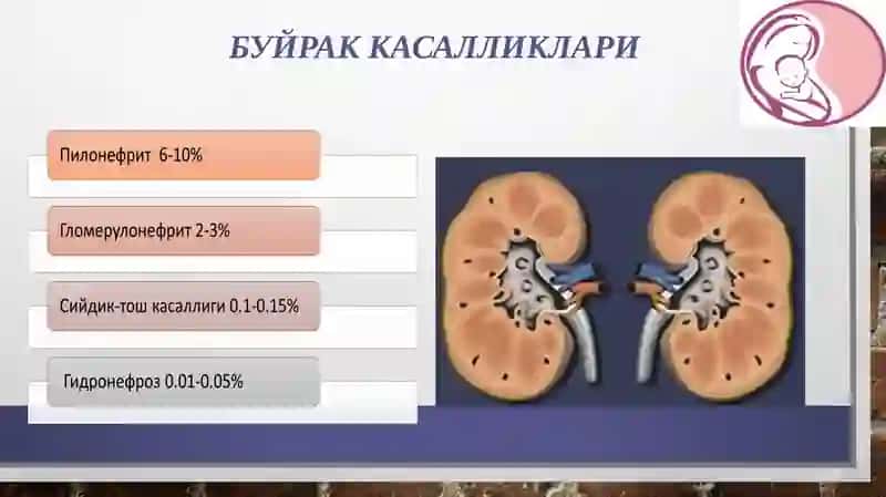 Сийдикйўли инфекцияларида ҳомиладорлик ватуғруқ 3