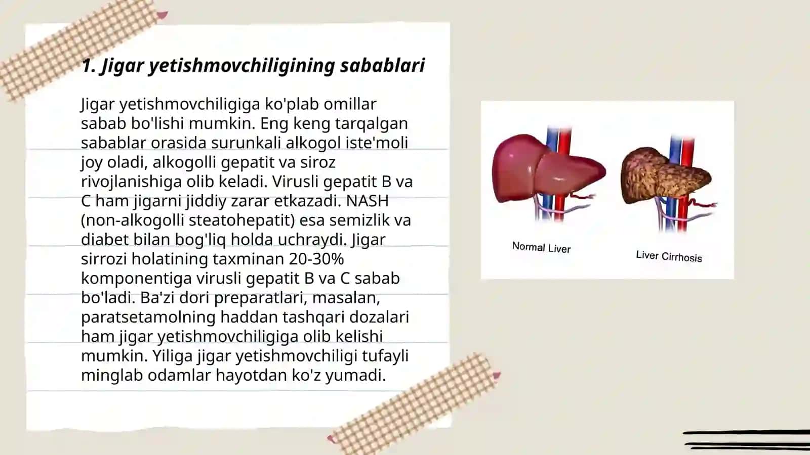 Jigar yetishmovchiligi sindromi 3