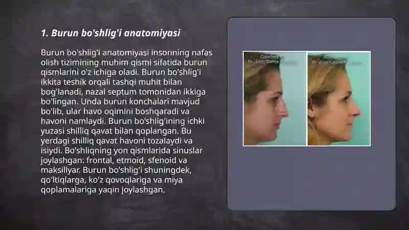 Burun bo'shlig'i anatomiyasi 3