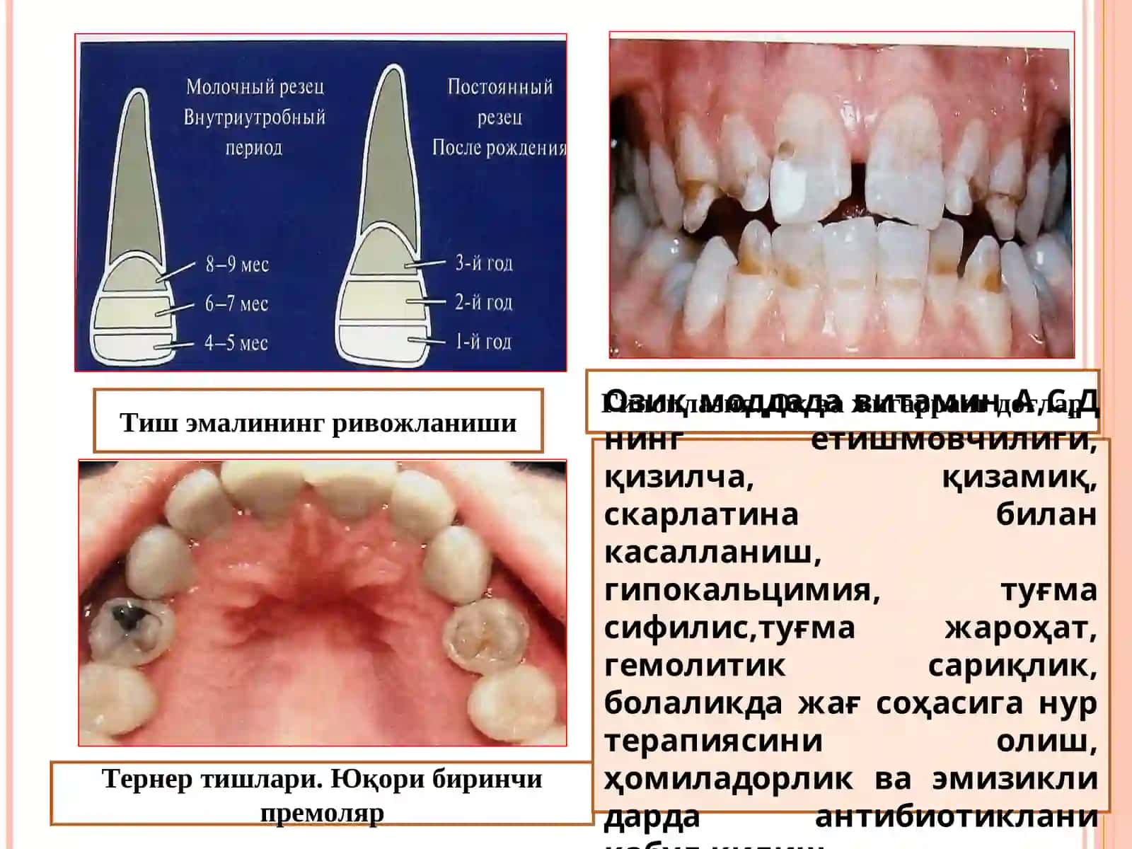 ТИШ РИВОЖЛАНИШИНГ НАСЛИЙ БУЗИЛИШИ 3