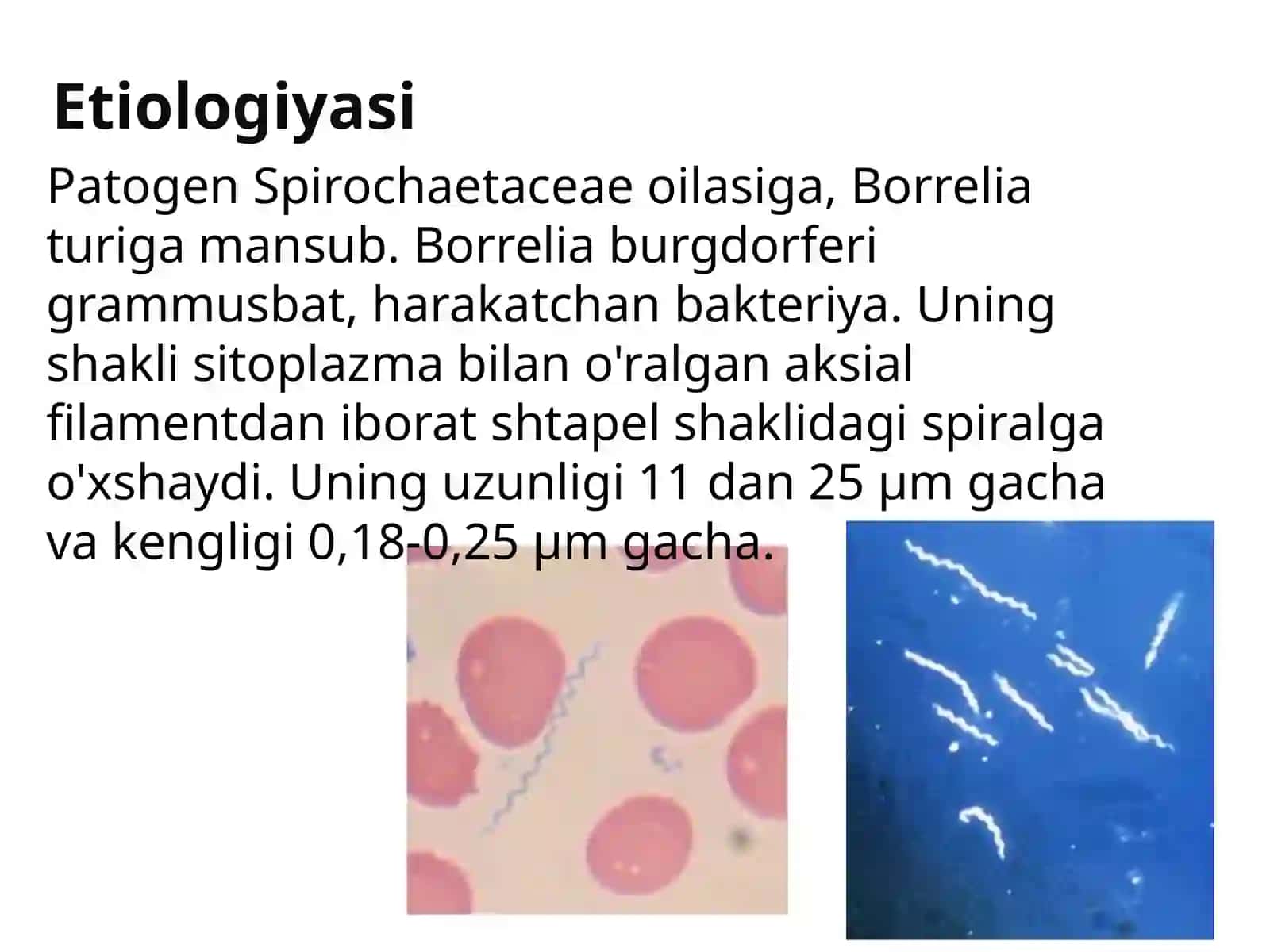 Borrelioz (Laymkasalligi) 3