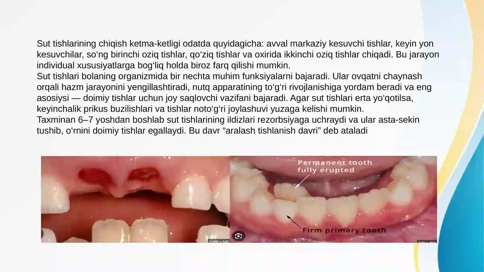 Sut tishlari davrida prikuslar holati 3