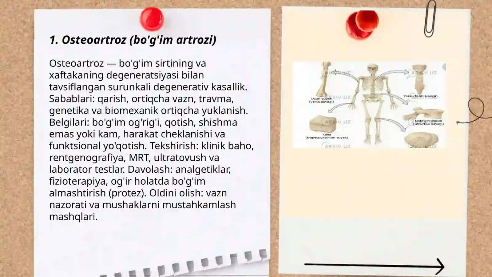 Osteoartroz (bo'g'im artrozi) 3