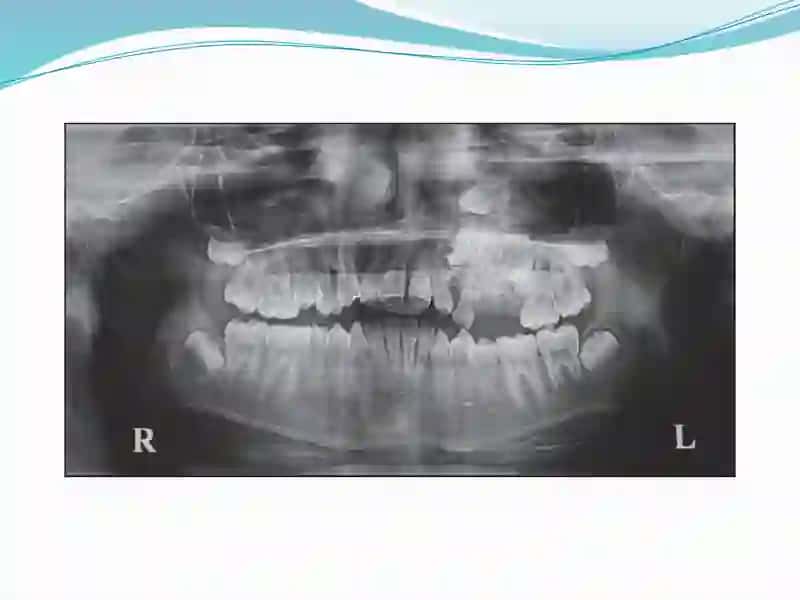 Specialized treatment for tooth extraction and surgery 3