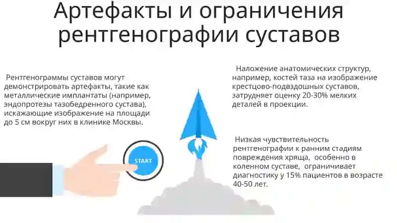 Рентгеноанатомия суставов 3