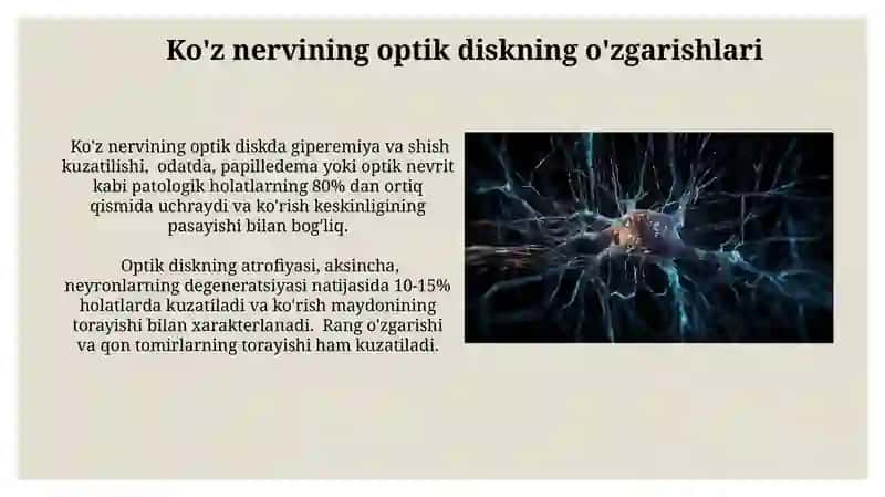 Ko'ruv nervi patologik anatomiyasi 3