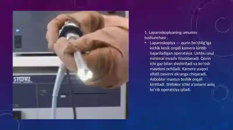 Laparoskopiyaning jarrohlikda qo‘llanishi 3
