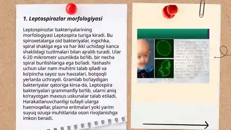 Leptospirozlar Marfalogiyasiy 3