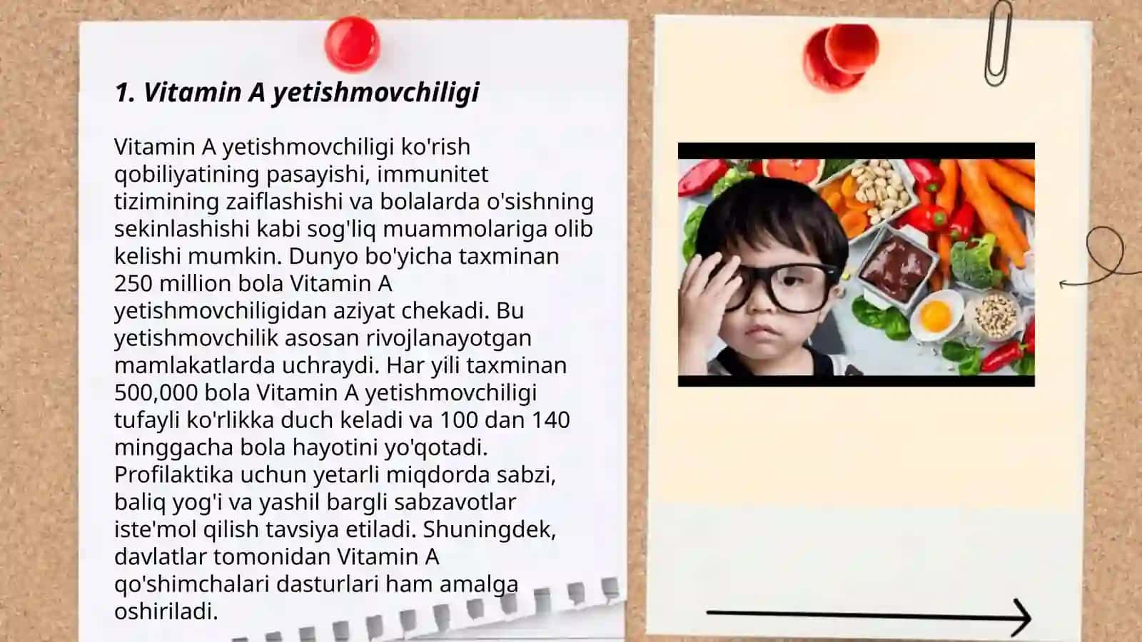 Vitamin A yetishmovchiligi 3