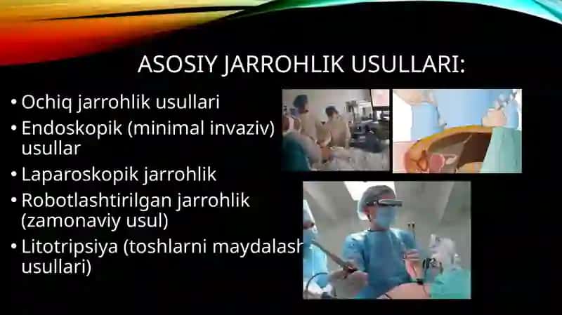 Urologiyada jarrohlik davolash usullari 3