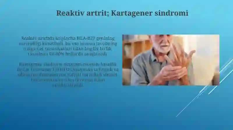 Reaktivar artrit va Kartagener sindromi 3