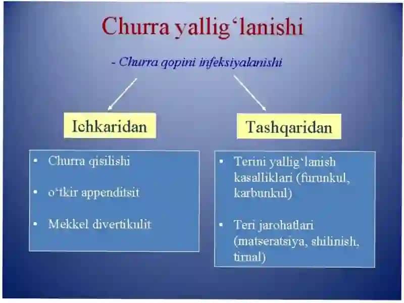 QORIN CHURRALARI VA ULARNING ASORATLARI 3