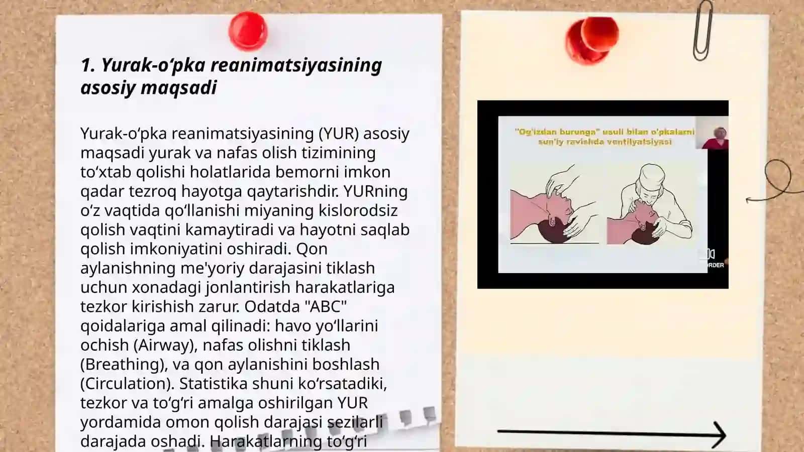 Yurak-o‘pka reanimatsiyasi 3
