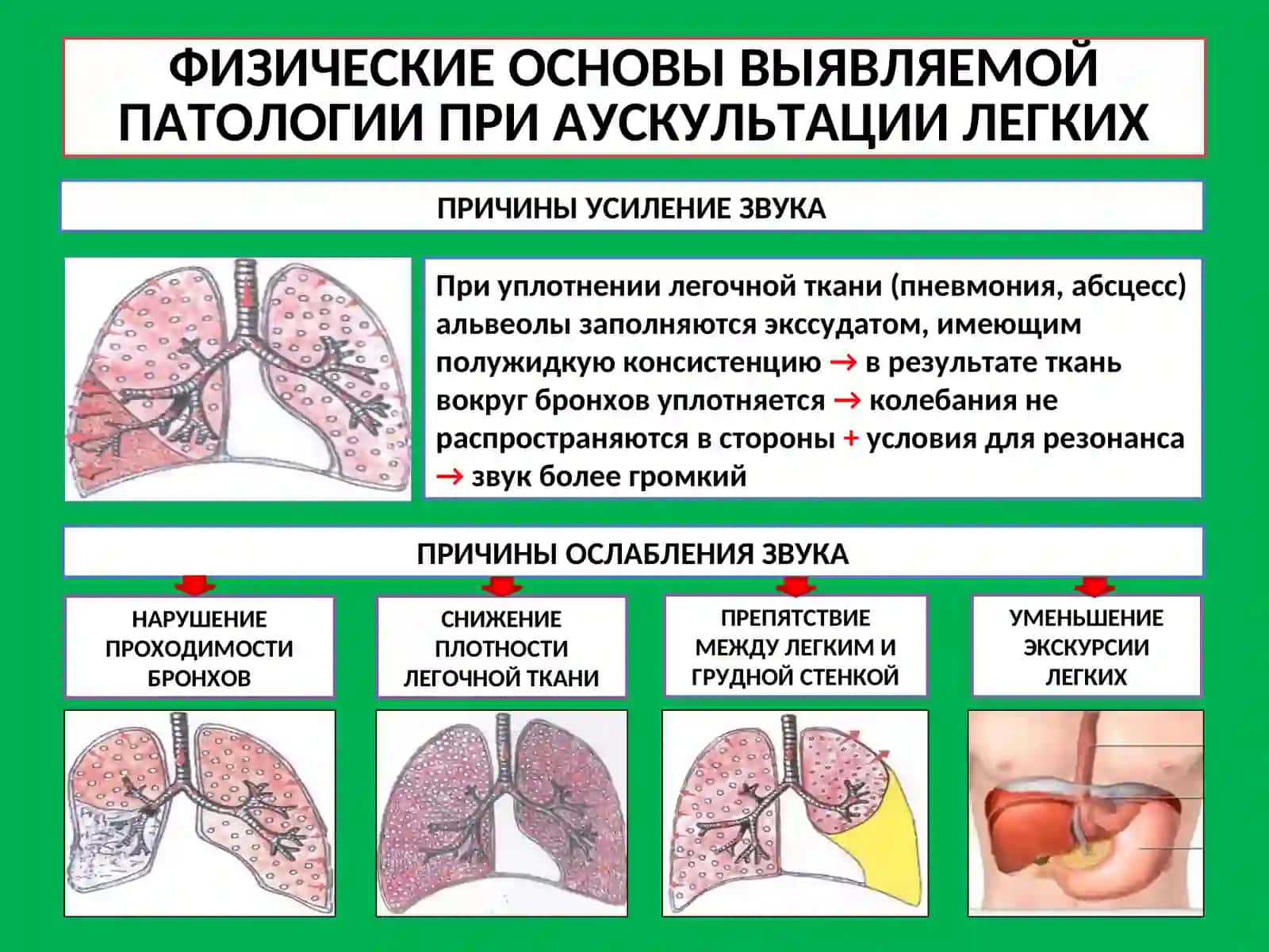 АУСКУЛЬТАЦИЯ ЛЕГКИХ, МЕТОДЫ ДОПОЛНИТЕЛЬНОГО ОБСЛЕДОВАНИЯ 3