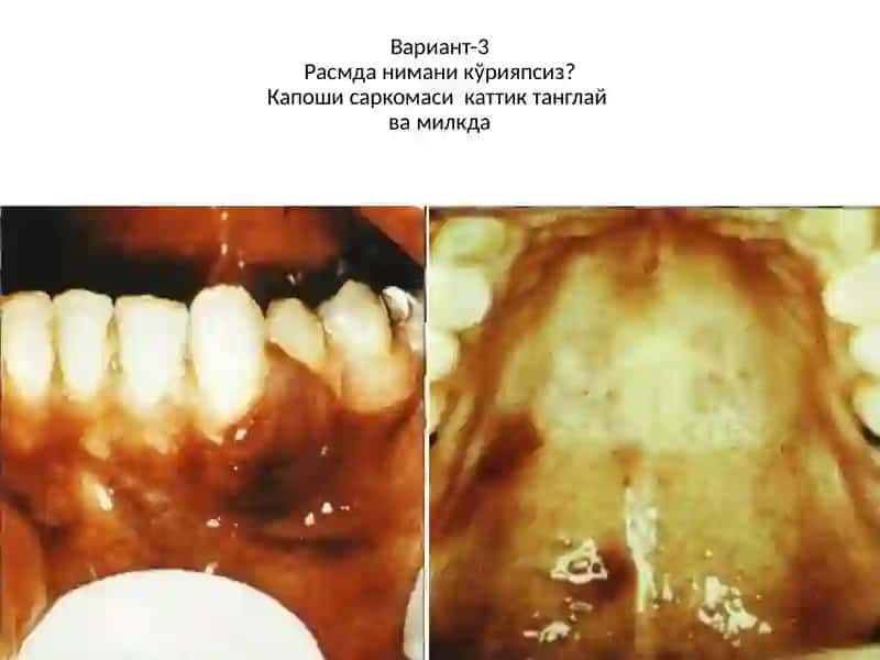 Расмдани маник ўрияпсиз 3
