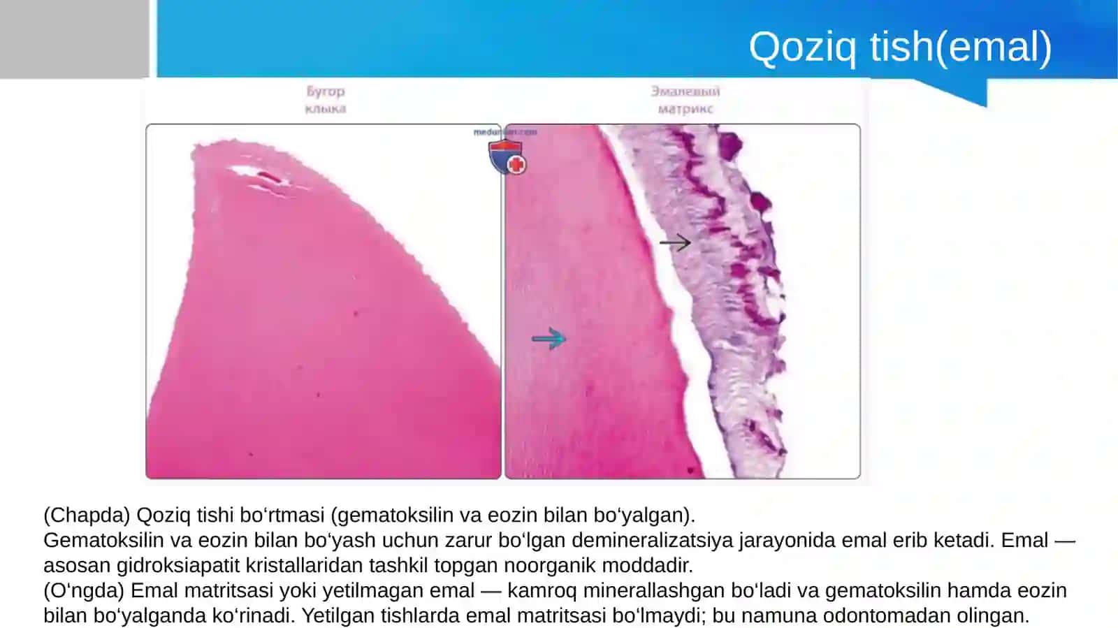 Ovqat hazm qilish tizimi. Tishlarning taraqqiyoti va tuzilishi.So’lak bezlari va murtaklar.Yutqin 3
