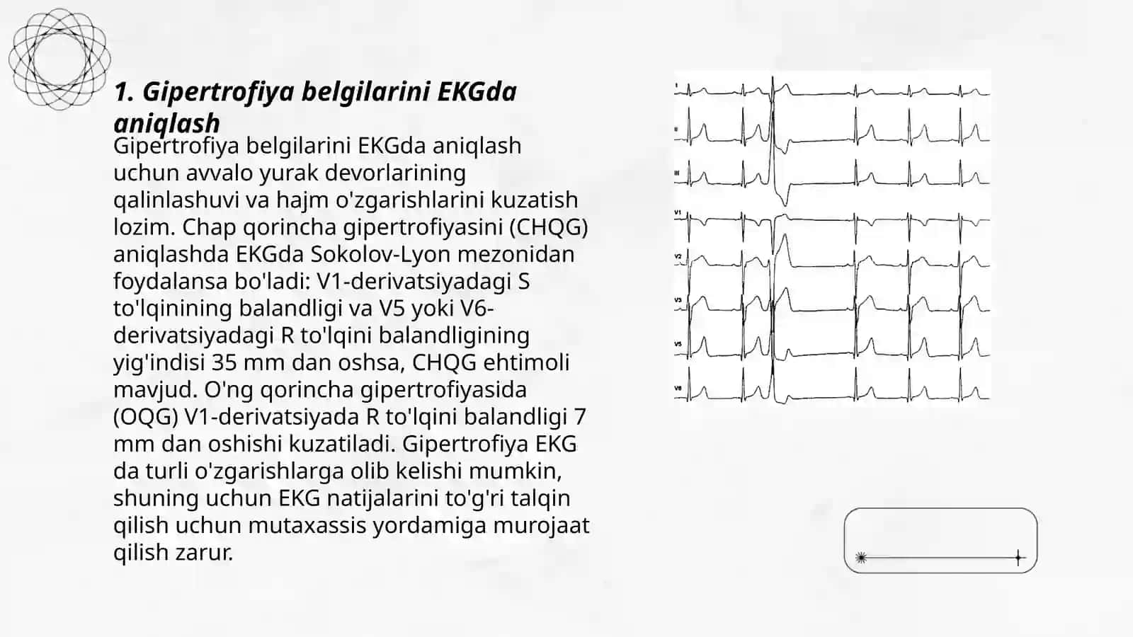 Gipertrofiya belgilari EKGda 3