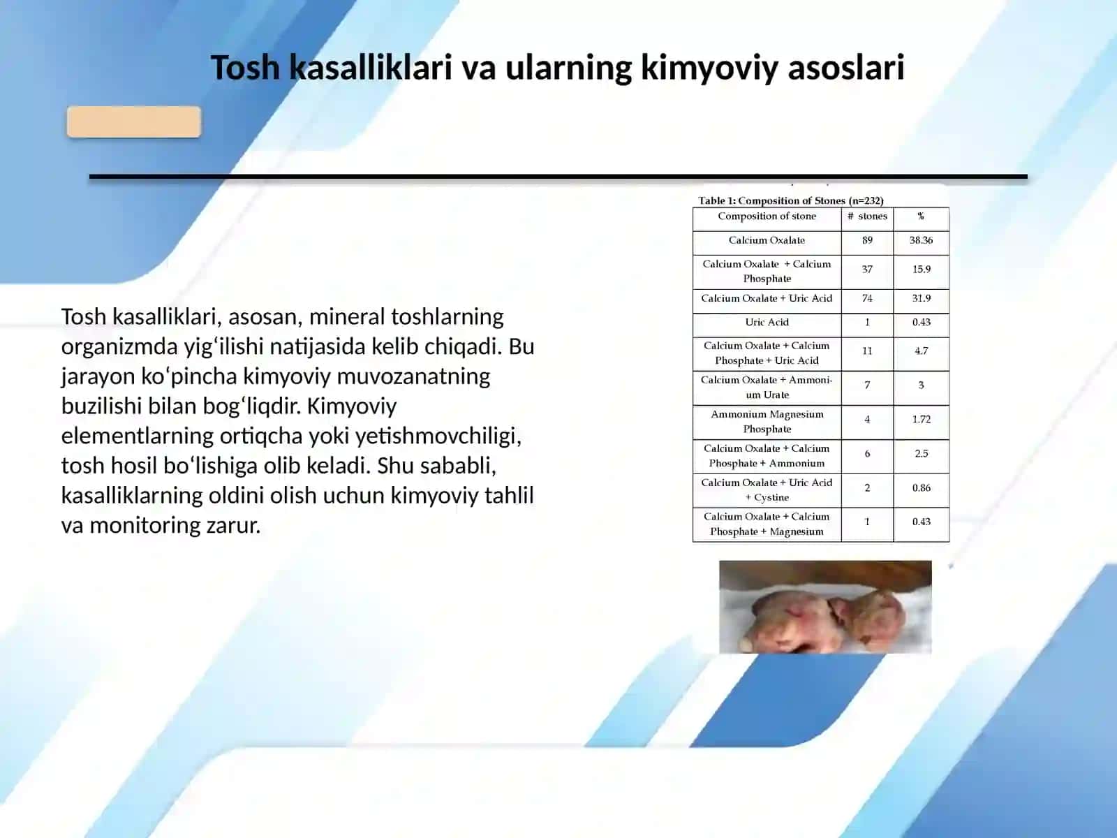 Tosh kasalliklarining kimyoviy asoslari 3