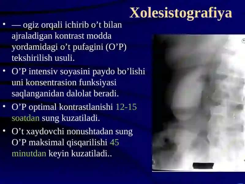GEPATOBILIAR TIZIMI KASALLIKLARINI NUR DIAGNOSTIKASI 3