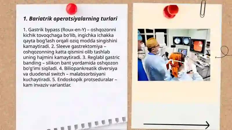 Bariatrik operatsiyalar 3