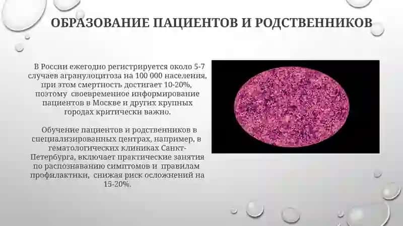Агранулацитоз 3