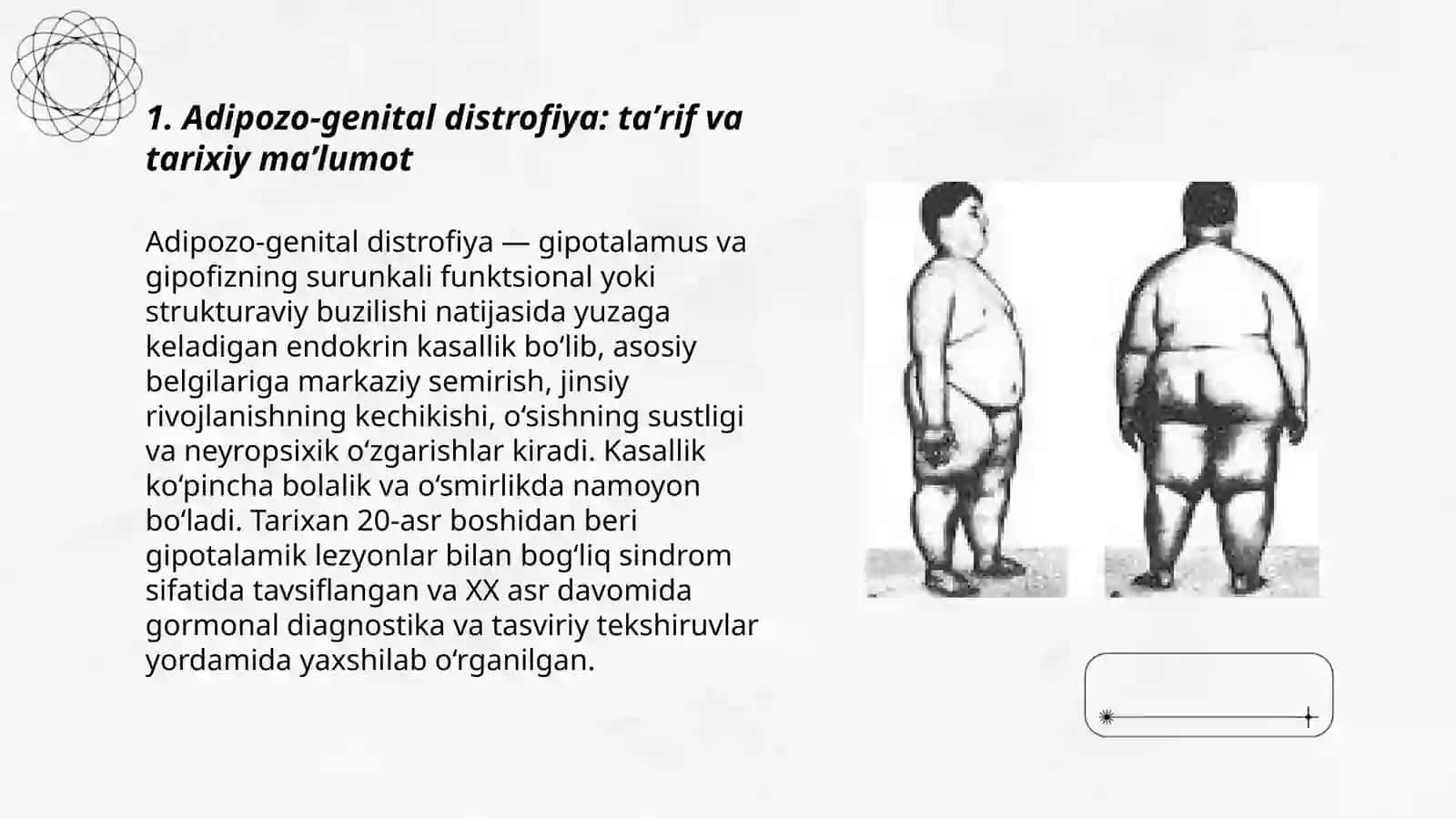 Adipozo-genital distrofiya 3