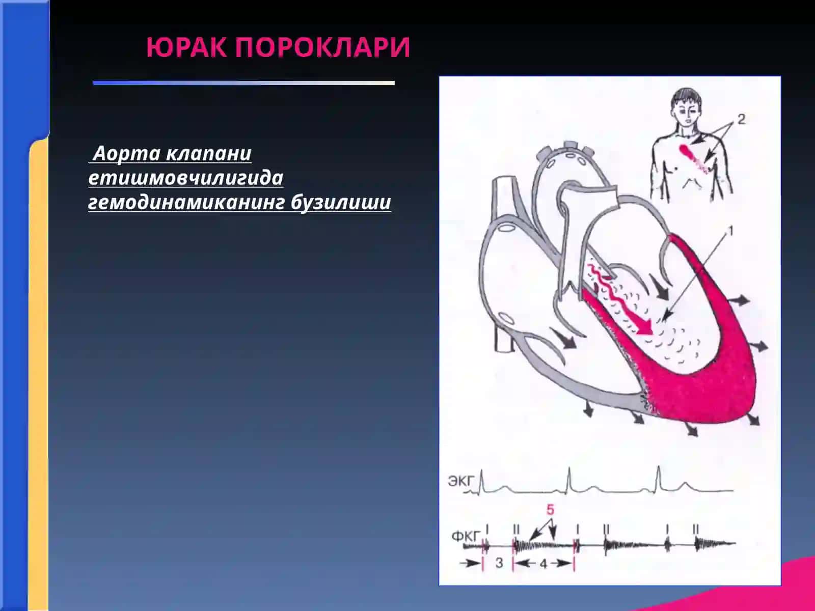 АОРТА КЛАПАНИНИНГ ЕТИШМОВЧИЛИГИ 3