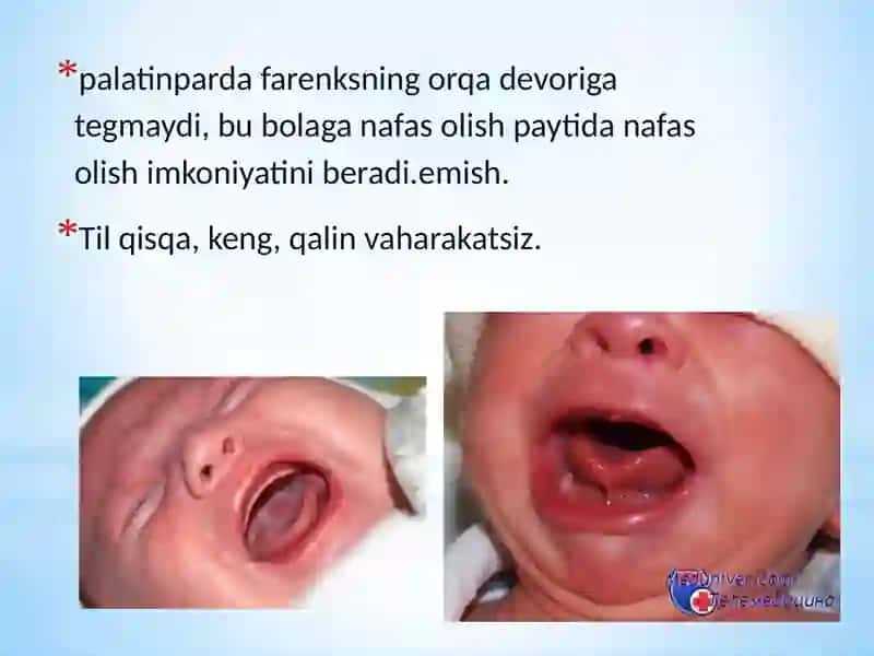 Bolalar kasalliklari propedevtikasi 3