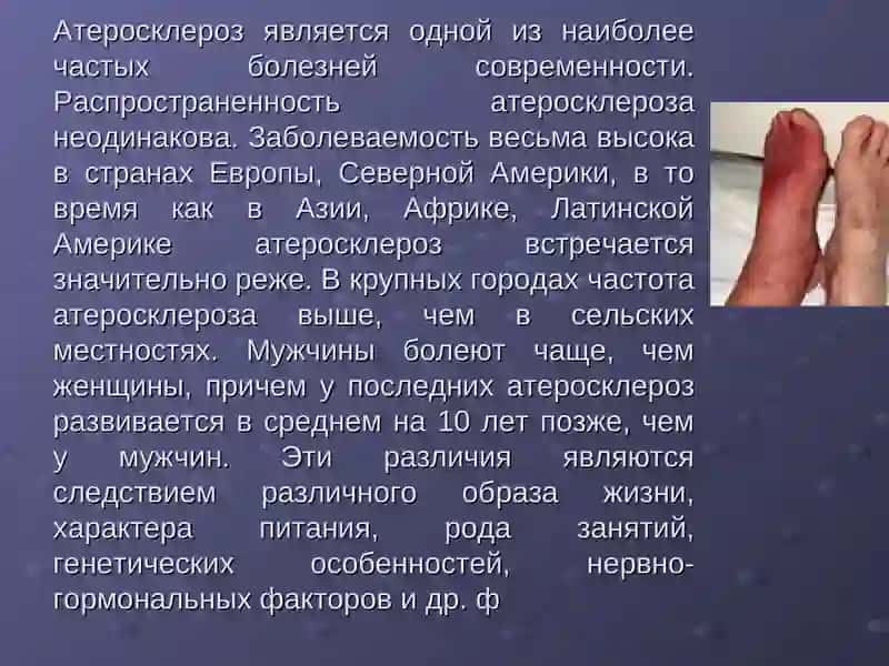 Атеросклероз нижней конечности 3