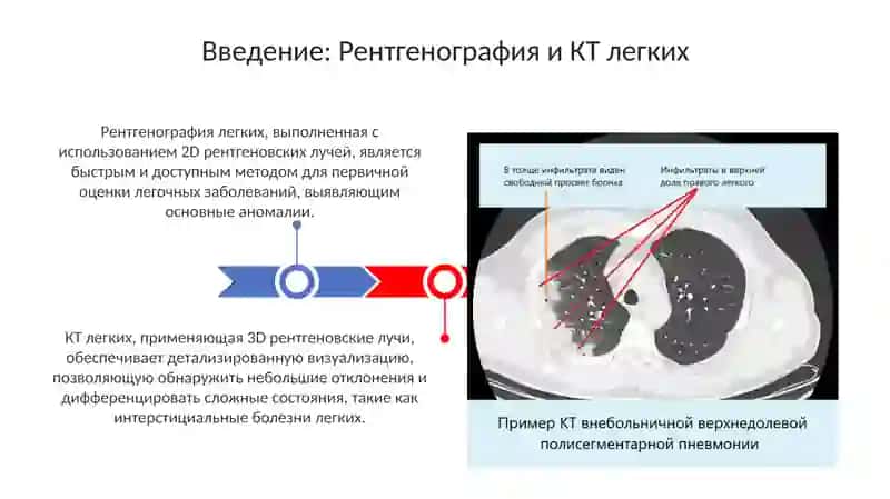 Презентация: Рентген и КТ легких 3