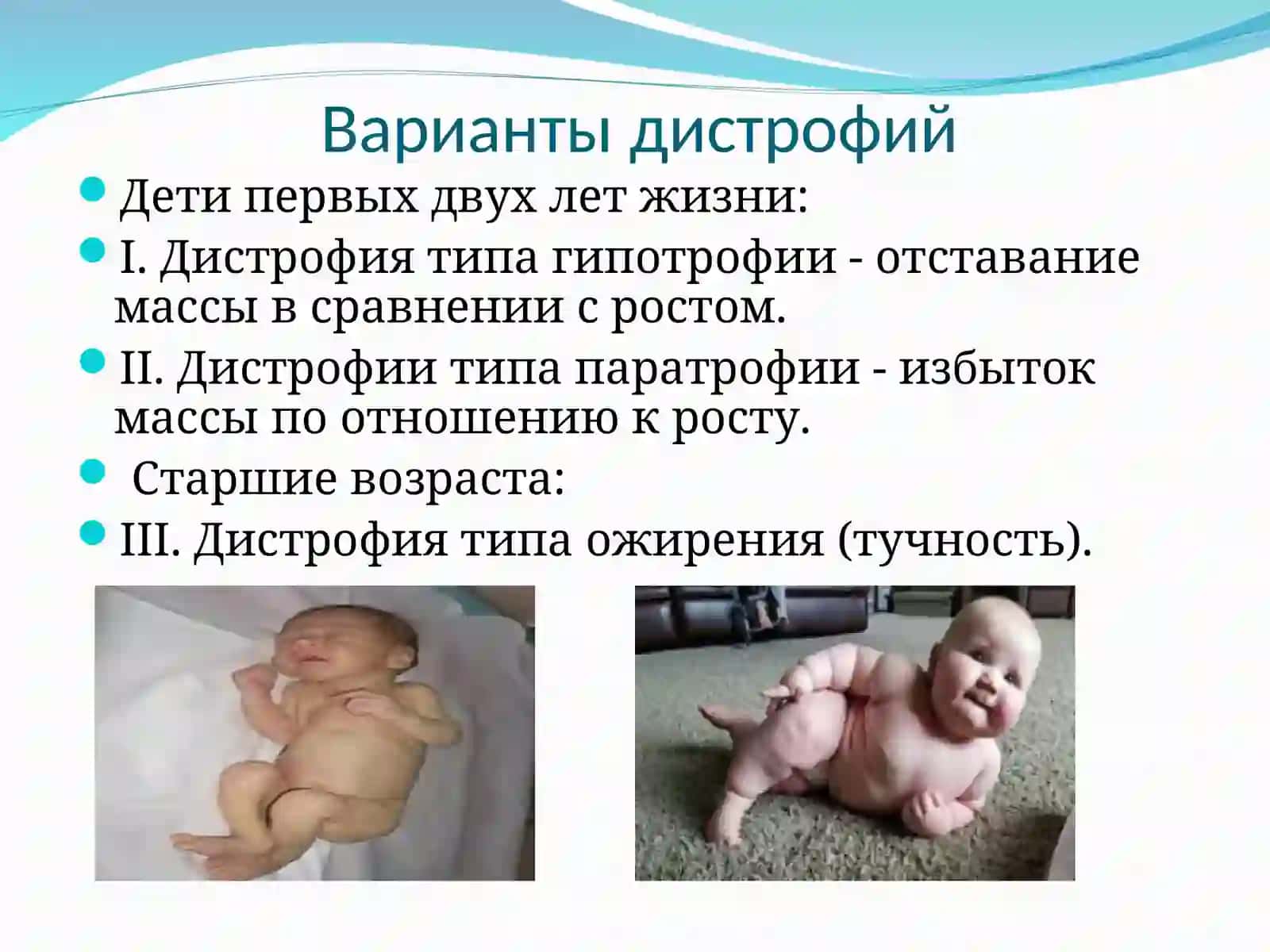 Белково-энергетическая недостаточность 3