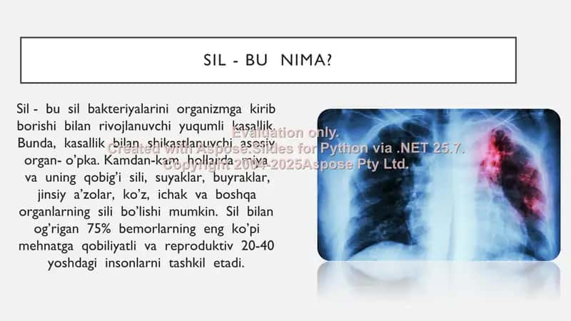 Bolalarda uchraydigan sil kasalligiga qarshi kurash 3