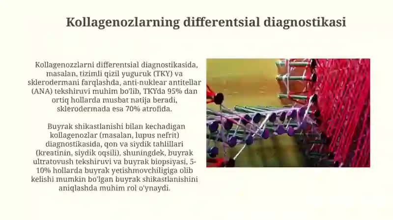 Kollagenozlar patogenezi va diagnostikasi 3