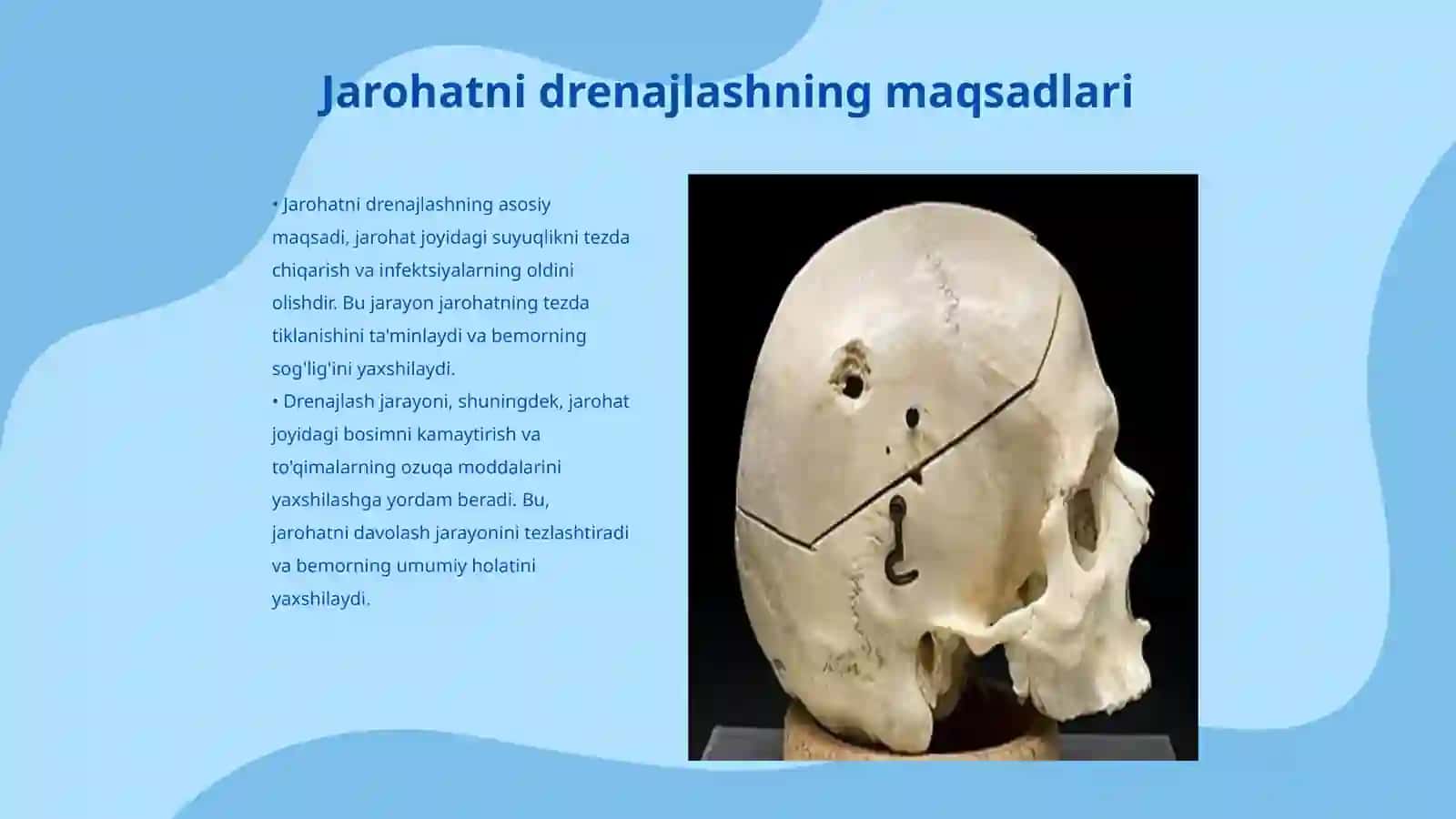 Jarohatni drenajlash usullari 3
