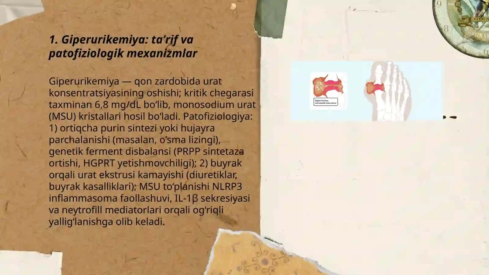 Giperurikemiya va podagra, davolash usullari 3