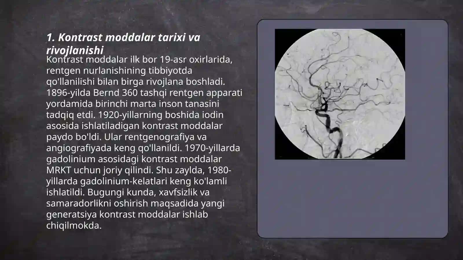Kontrast moddalar tarixi va rivojlanishi 3